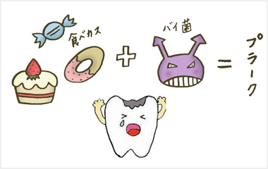 虫歯の原因