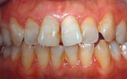 Before