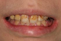 Before