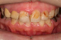 Before