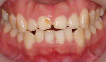 Before