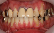 Before