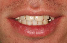 Before