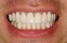 After