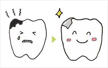虫歯、歯周病、入れ歯の治療の多くが保険内で治療できます