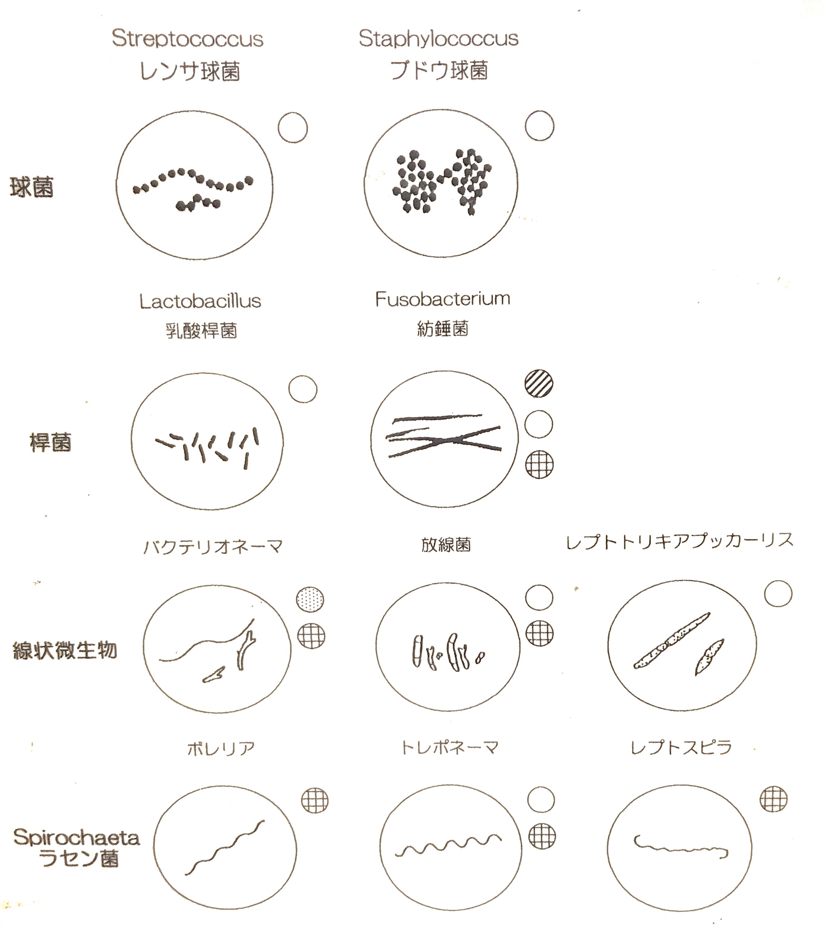 表