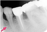 CASE 1