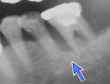 CASE 2