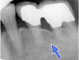 CASE 2