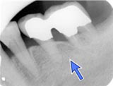 CASE 2