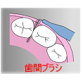 歯間ブラシ